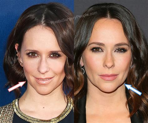 jennifer love hewitt plastic surgery|Jennifer Love Hewitt: BEFORE and AFTER 2022.